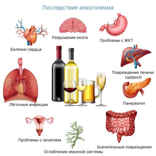 Почему люди употребляют алкоголь? Психология алкоголика 1